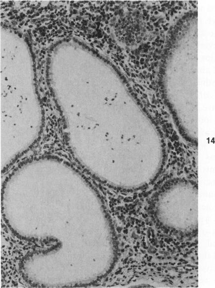 Figure 14