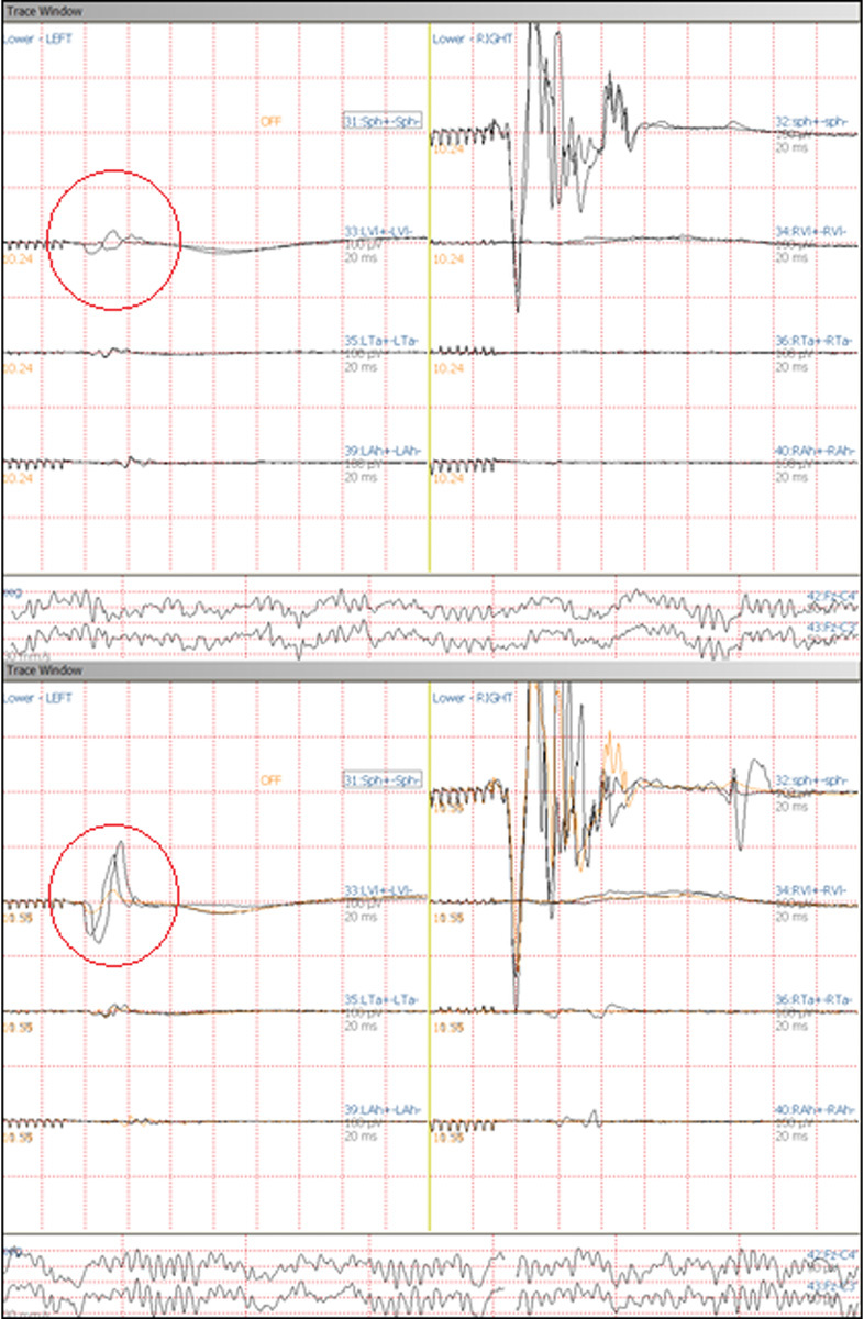 Fig. 4