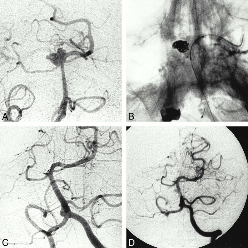 fig 3.