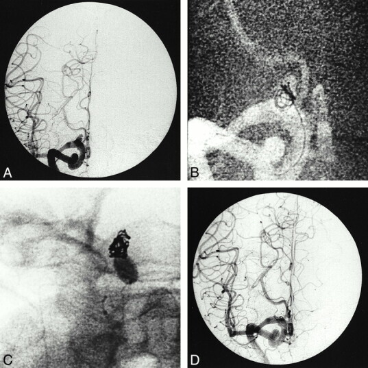 fig 1.