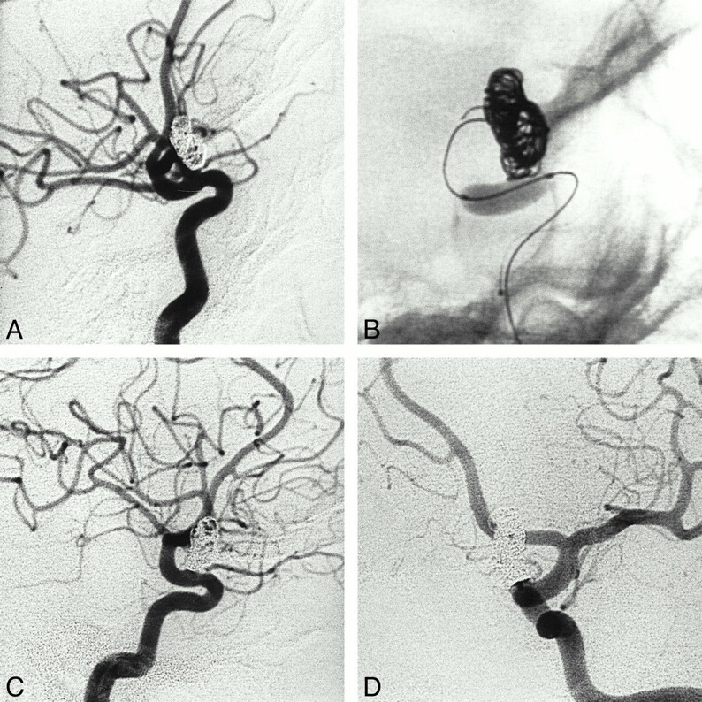 fig 2.