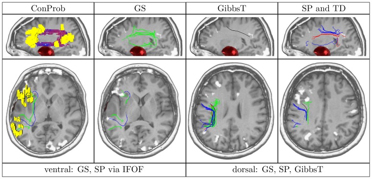 Figure 12