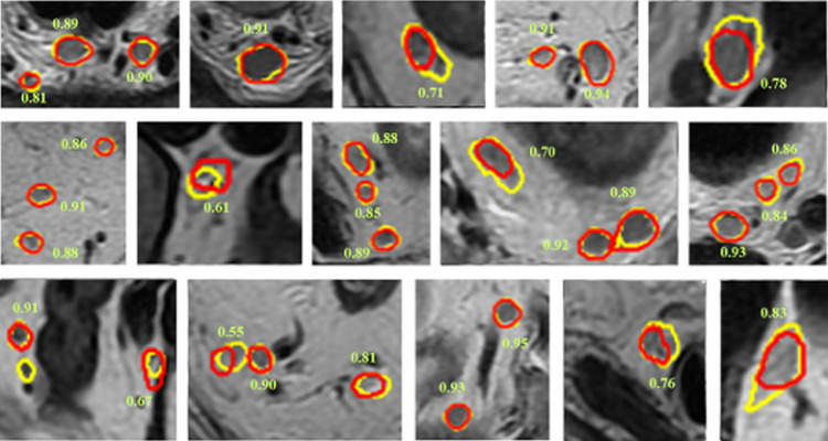 Fig. 5