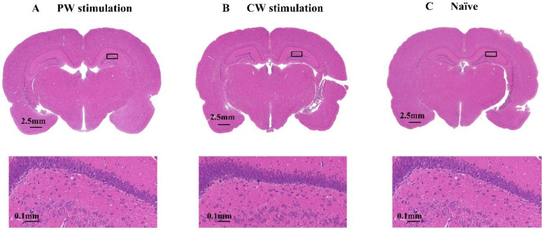 Figure 11