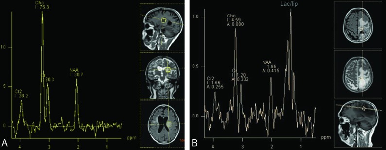 Fig 10.