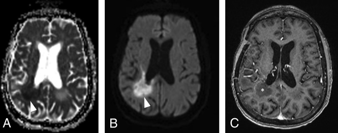 Fig 12.