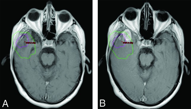 Fig 3.