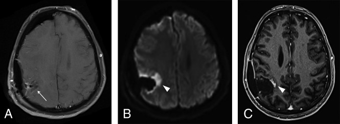 Fig 2.