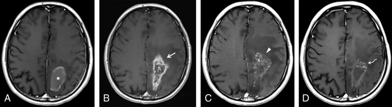 Fig 5.