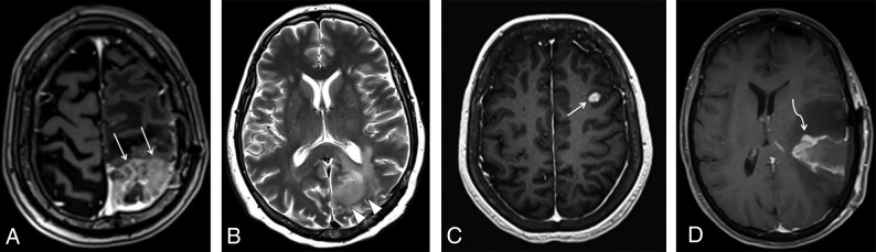 Fig 1.