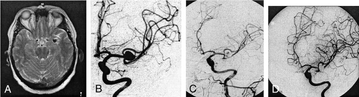 Fig 3.