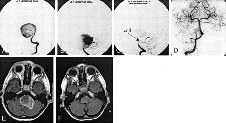 Fig 1.