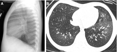 FIG. 39.