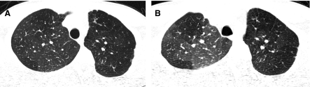 FIG. 14.