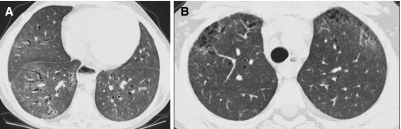 FIG. 46.