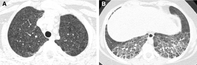 FIG. 41.