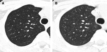 FIG. 12.