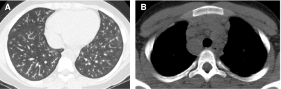 FIG. 48.