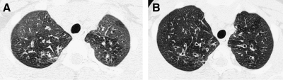 FIG. 5.