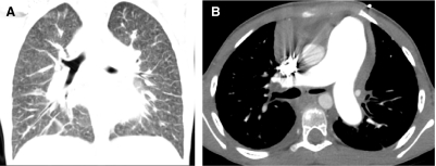 FIG. 37.