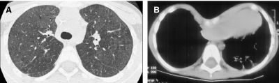 FIG. 34.