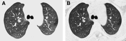 FIG. 11.