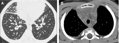 FIG. 36.