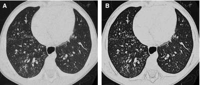 FIG. 10.