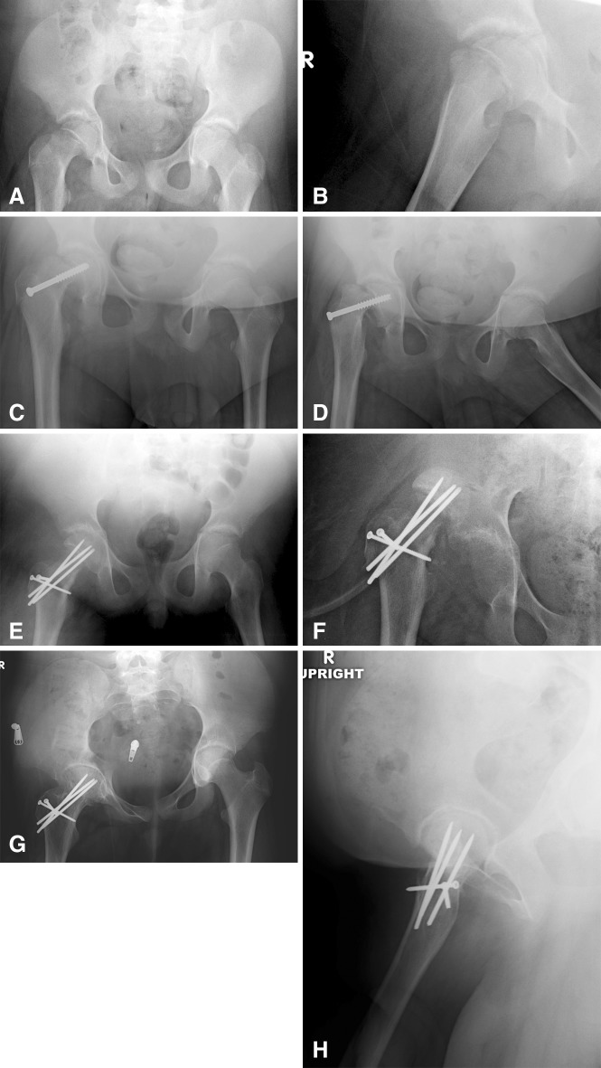 Fig. 2A–H