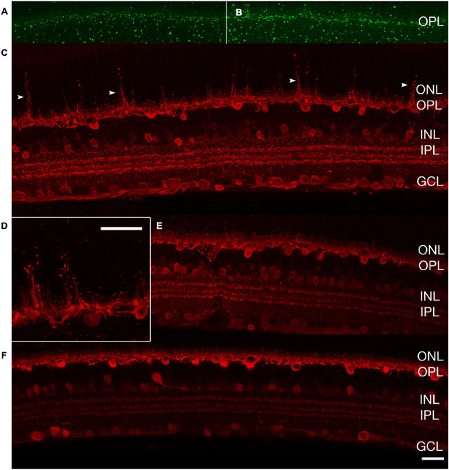 Figure 11.