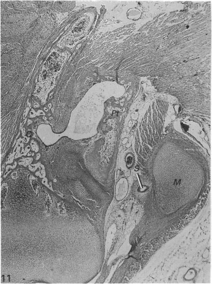 Fig. 11