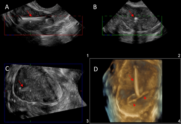 Fig. 3