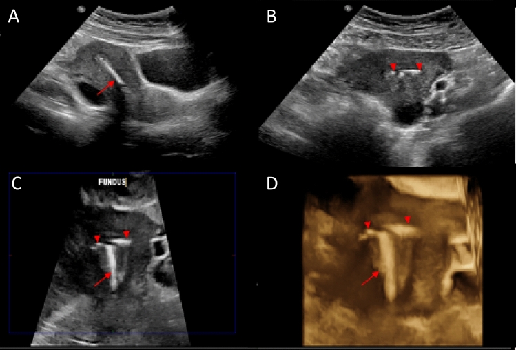 Fig. 2