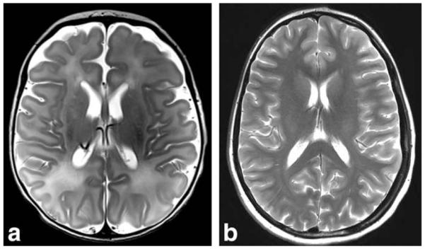 FIG. 10