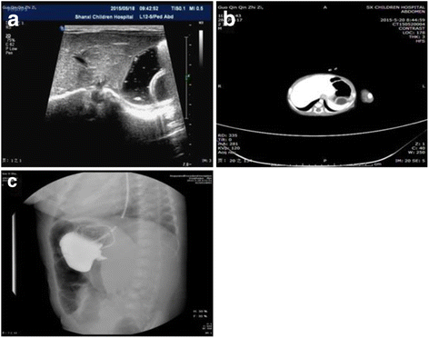 Fig. 1