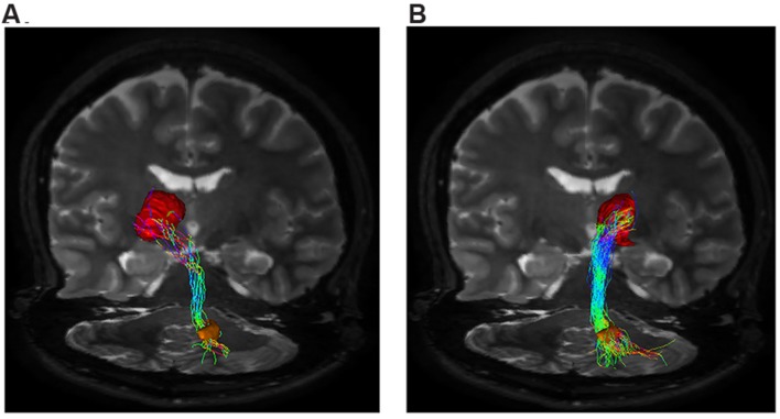 FIGURE 3