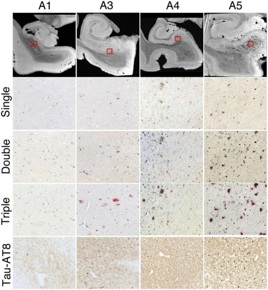 FIGURE 3