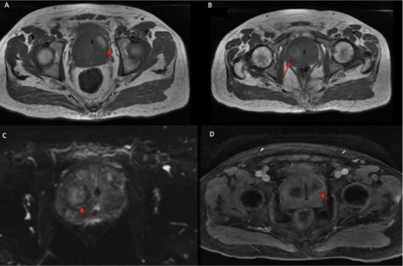 Fig. 1