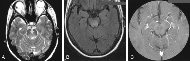 Fig 1.