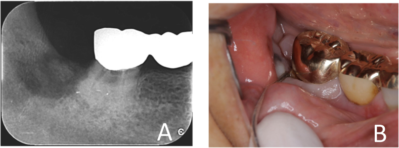 Figure 2