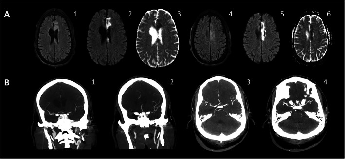 Fig. 6