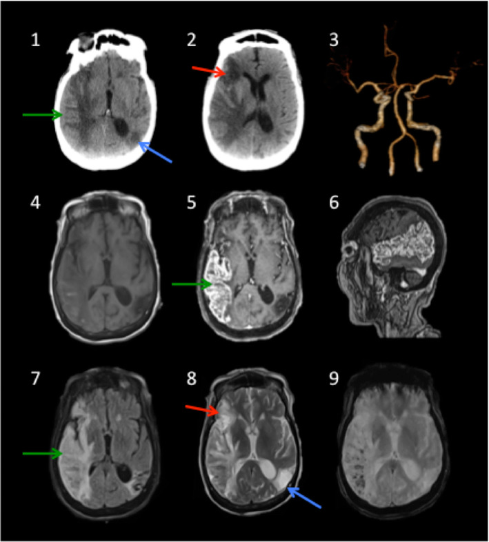 Fig. 5