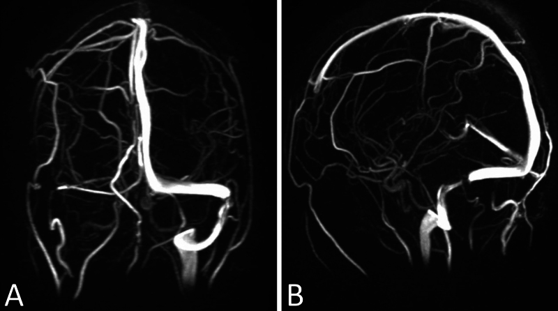 FIG. 2.