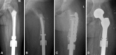 Fig. 3A–D