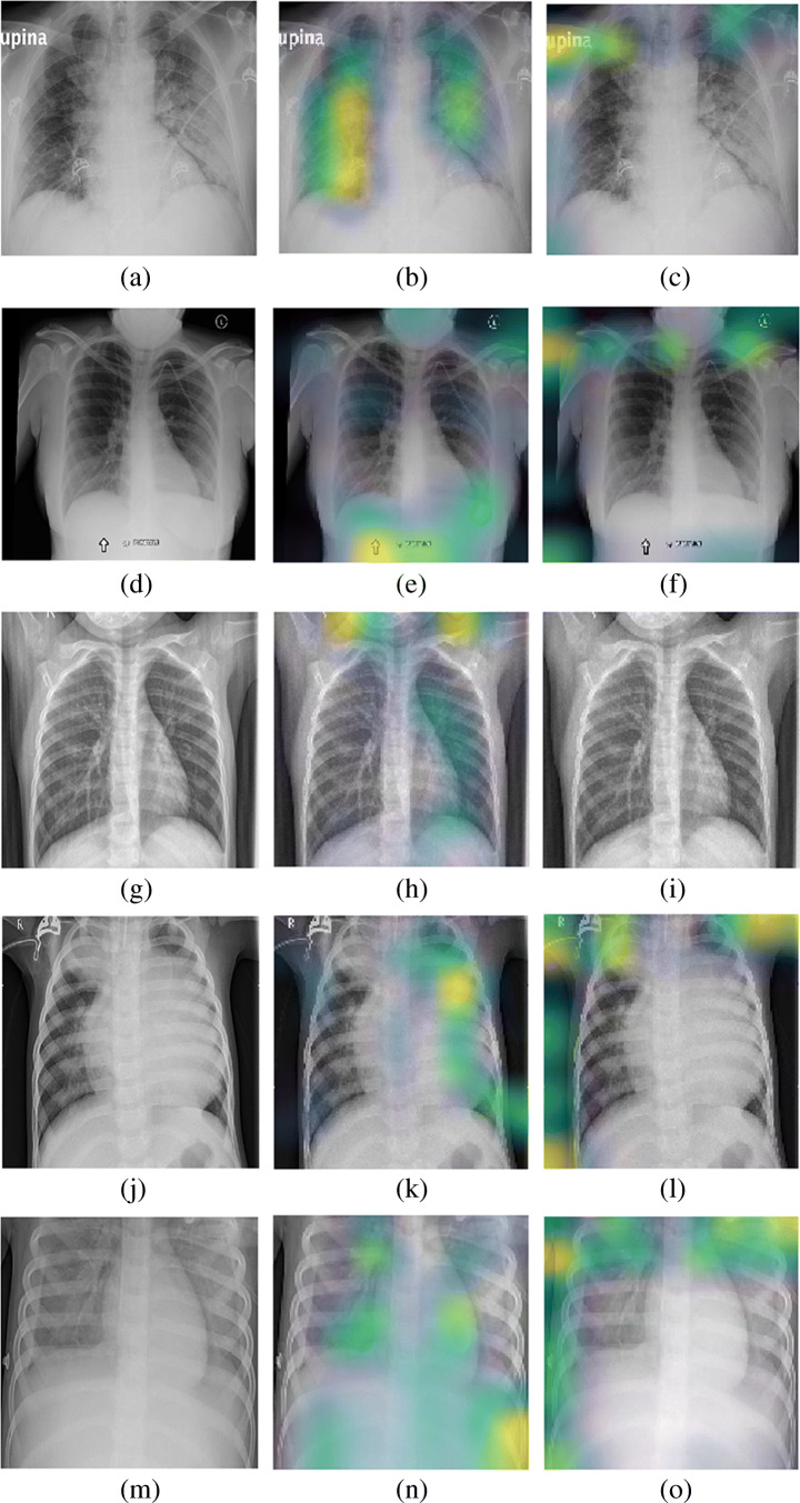 Fig. 9