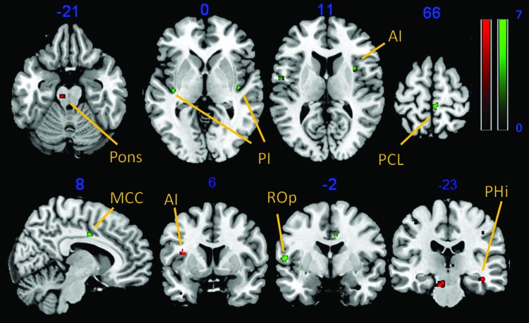 FIG. 3.