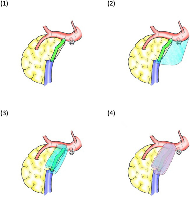 Fig. 2