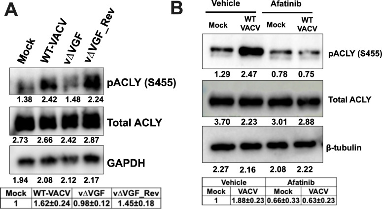 Western blots depict pACLY and total ACLY levels in different VACV strains and in the presence of Afatinib. Phosphorylation of ACLY increases in WT-VACV but not vΔVGF. Afatinib treatment reduces pACLY in VACV-infected cells.
