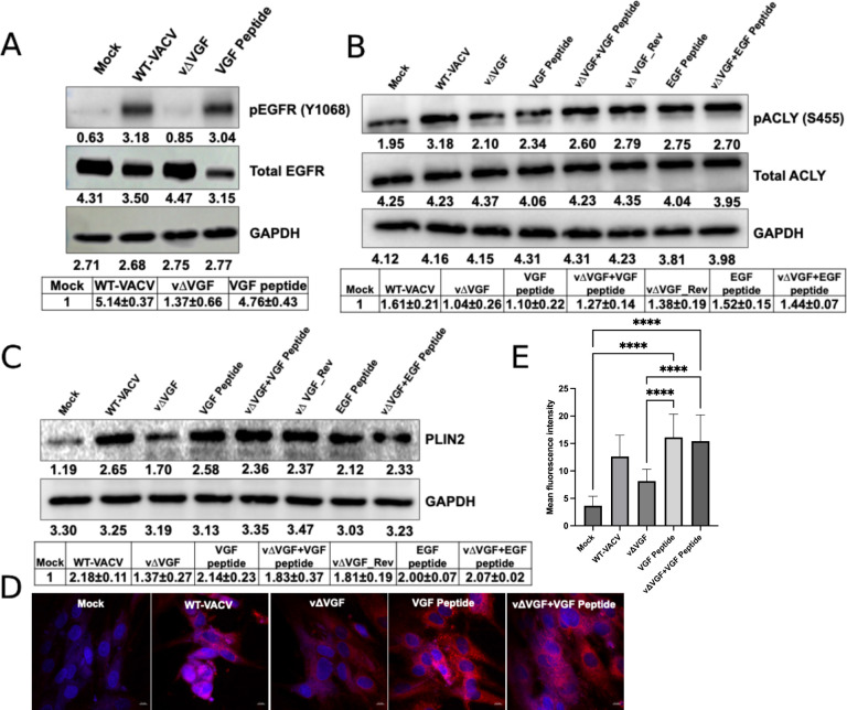 Western blots depict pEGFR, pACLY, and PLIN2 levels across VACV infections and VGF and EGF peptide treatments. Fluorescence images highlight lipid droplet accumulation with VGF peptide treatments significantly increasing lipid droplets.