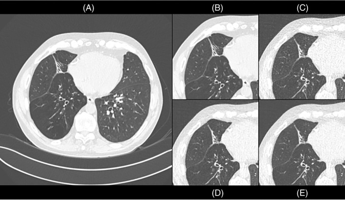 FIGURE 1